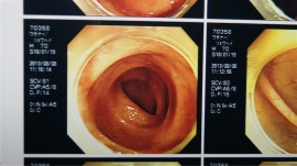 腸